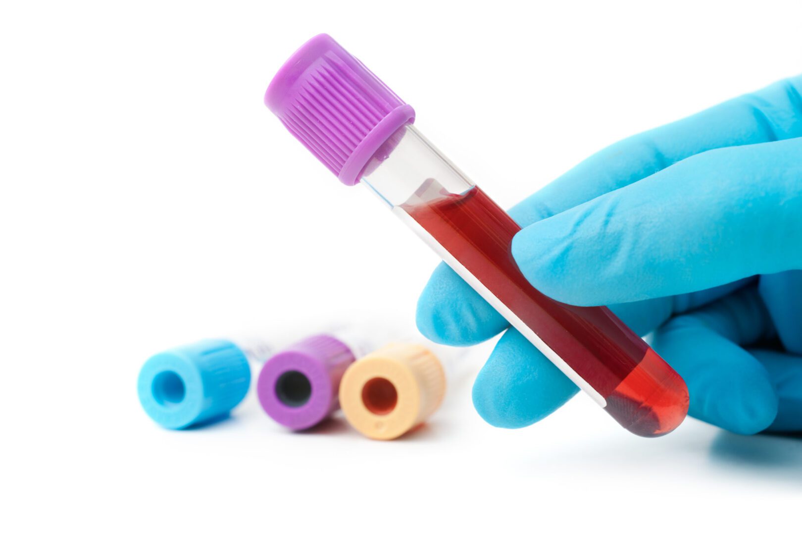 A person holding a tube of blood in front of some colored tubes.